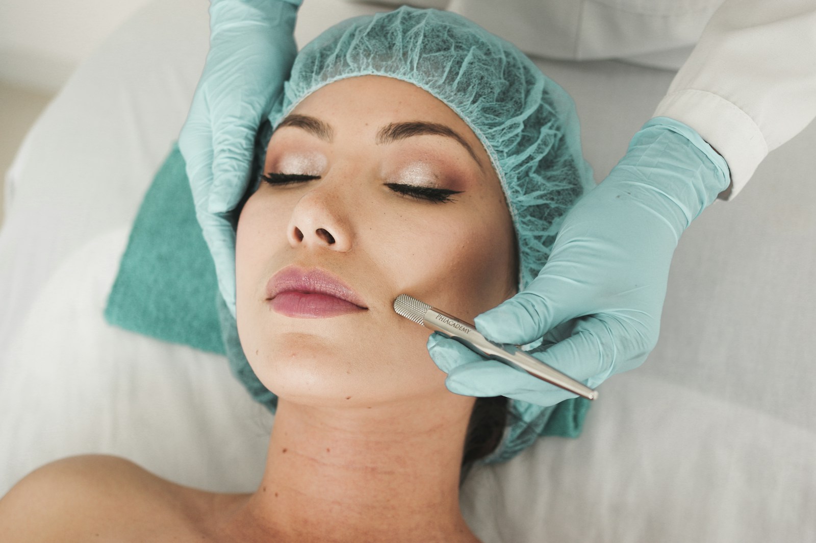 microneedling behandling ; microneedling